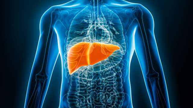 3D illustration of liver cancer