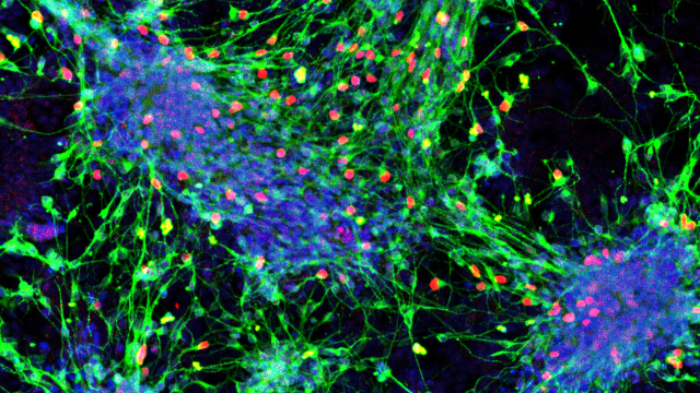 Microscopic image of sensory interneurons derived from mouse cells