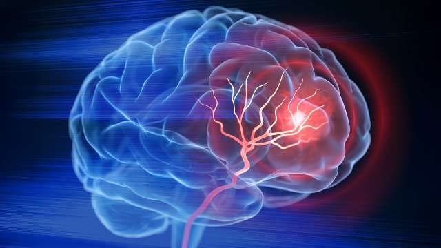 3D holographic brain with tumor