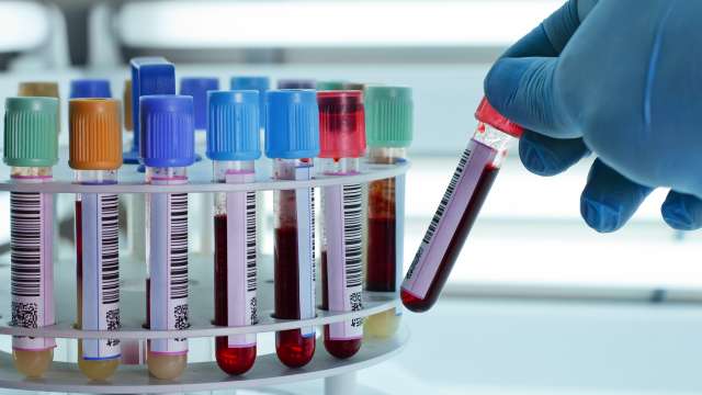Technician placing blood tubes in the laboratory centrifuge.