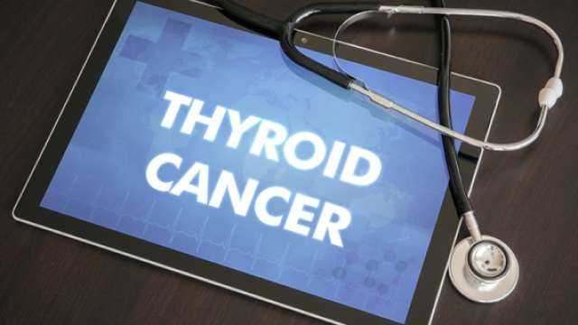 Thyroid Cancer
