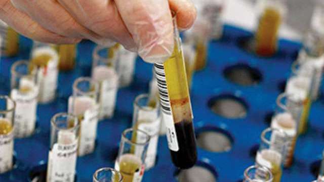 test tube with blood