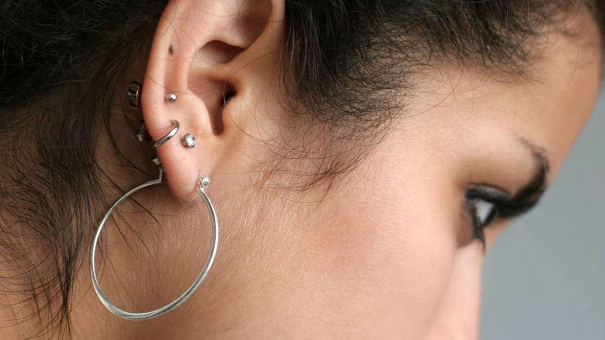 Infected ear piercing - Stock Image - C028/4501 - Science Photo Library