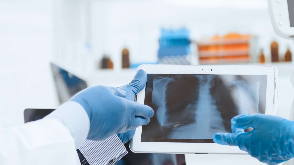 Treatment for rib injury often includes pain management UCLA Health