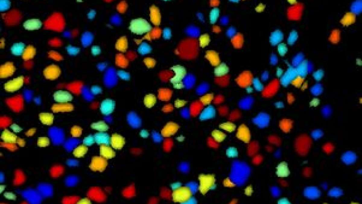 UCLA scientists receive prestigious BRAIN Initiative grant from NIH ...