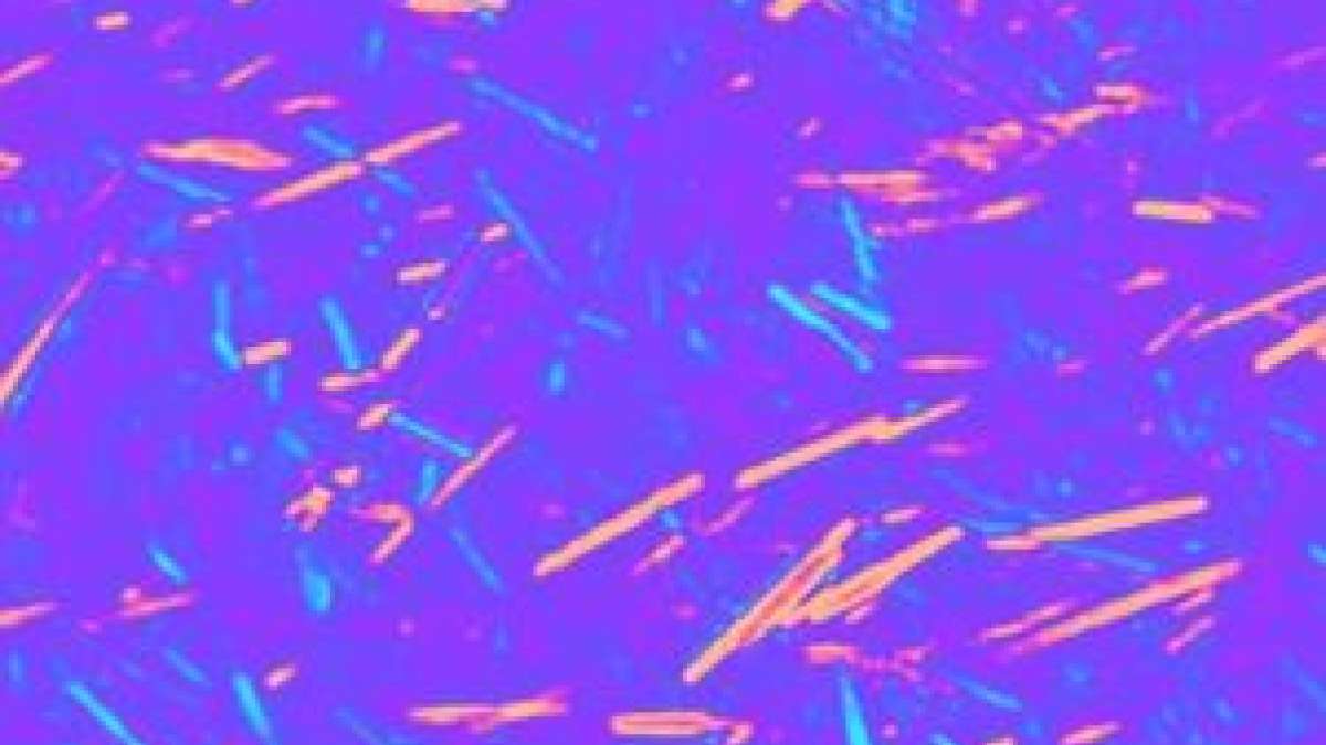 Diagnosing gout could become easier, more cost-effective with new portable  device | UCLA Health, image size:1200x675