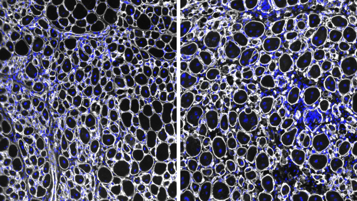 Muscle stem cells build resilience but lose regenerative power with age
