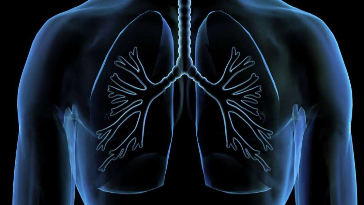 Improve Lung Cancer Outcomes With Low Dose Ct Screening Ucla Health