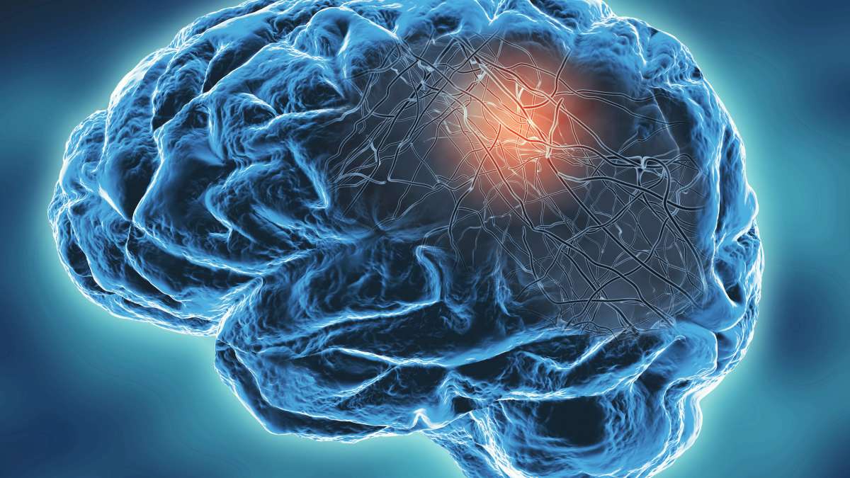 Competitive greatness' drives 5 years of Parkinson's research