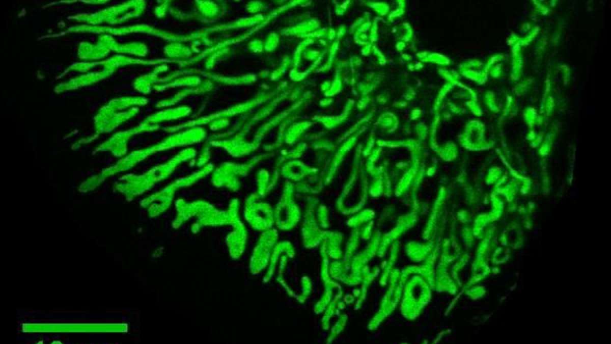 Photo: Uclahealth EFHD1 Protein Blockade Reduces Liver Damage and Inflammation by Up to 60%