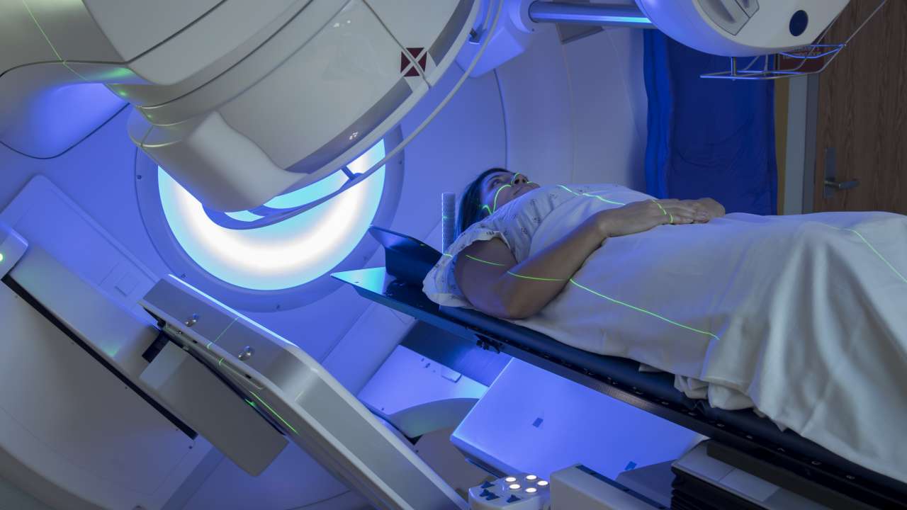 Radiotherapy 