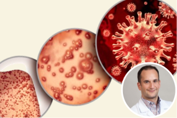Photos of the monkeypox virus and the principal investigator of the study, Raphael Landovitz