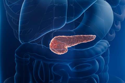 3d illustration of pancreas cancer