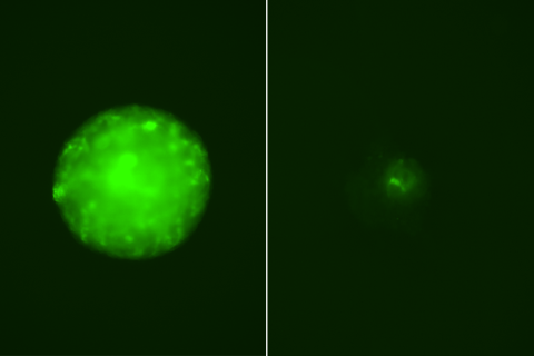 Glioblastoma cells captured in green view.