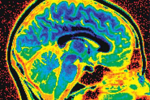 Colored scan of the brain