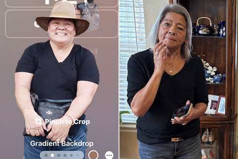Cynthia before and after Gastric Sleeve Surgery.