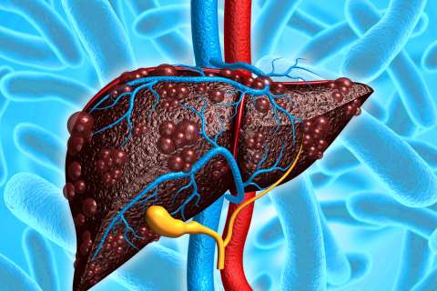 Illustration of Liver Disease Microbiome. An irritated liver, with blue and red veins attached to it. 