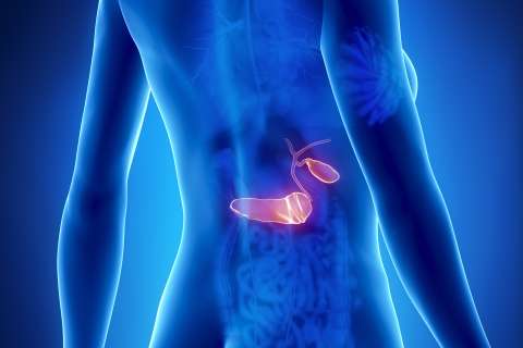 3D illustration of pancreas cancer