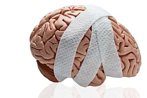 Long Term Symptoms Indicate Post Concussion Syndrome Ucla Health