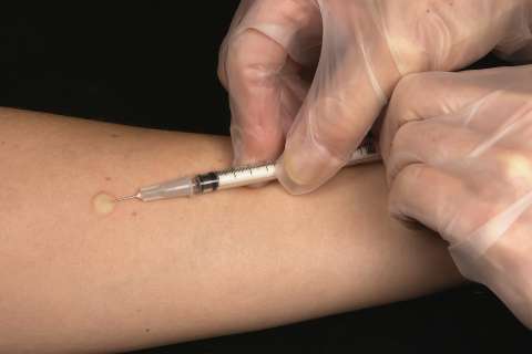 TB testing