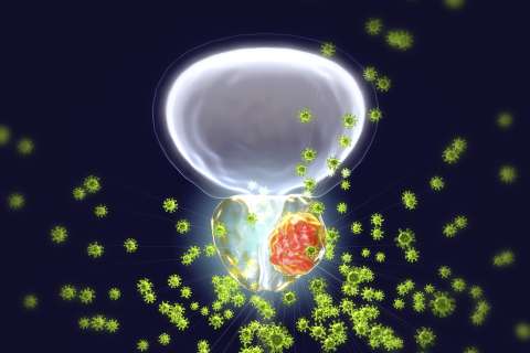 Prostate cancer cells
