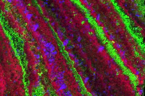 Bacteria in kidney stones