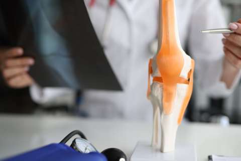 Knee joint with doctor holding x-ray.