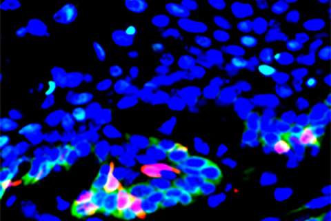 Cancer stem cells
