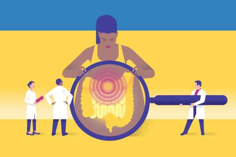 Colorectal Cancer Screening Graphic