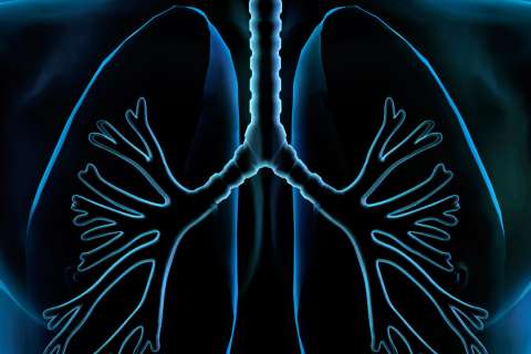 Lung Illustration, X-ray