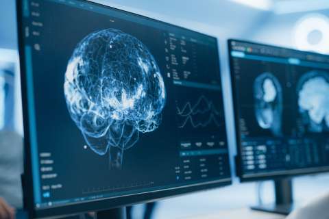 3D brain rendering and MRI slices on computer monitors