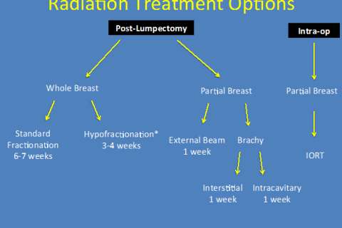 radiation treatments