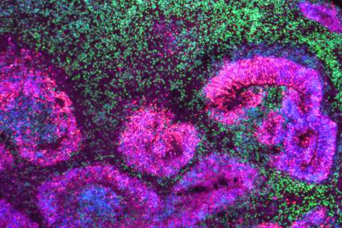 Microscopy image of a cortical organoid, a stem cell-derived model that mimics the developing human brain. The circular rosettes are clusters of neural stem cells giving rise to neurons, shown in green.