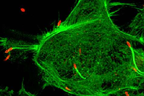 Burkholderia pseudomallei infecting a human cell