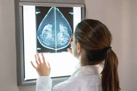 A doctor looks at a mammogram.