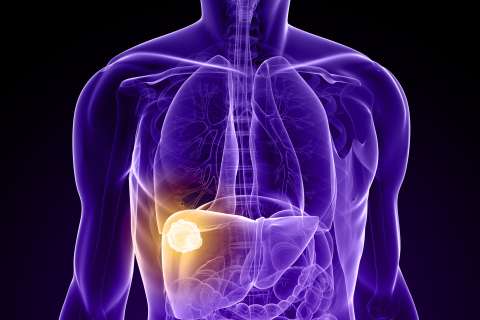 Liver Tumors