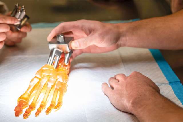 A prosthetic ankle model