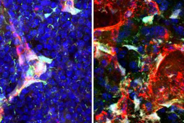 Expression of pleiotrophin in bone marrow blood vessels