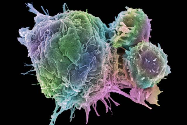 Cancer cell and T lymphocytes