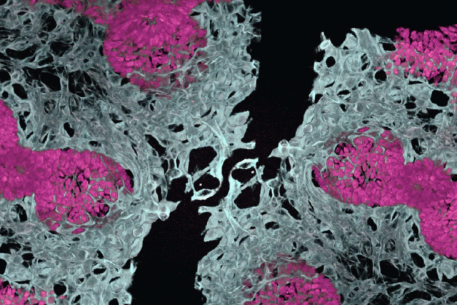 microscopic image of an embryonic mouse lung showing blood vessels (in white) and air sacs (in pink)