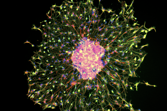 Fluorescent image of neural stem cells showing branching structures and glowing cell bodies under a microscope.