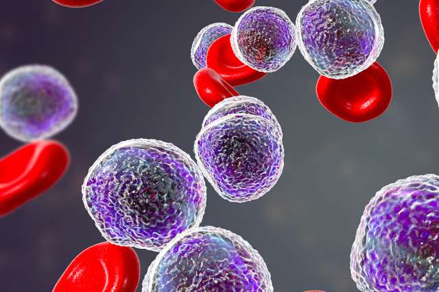 Leukemia cells Lymphoma cells