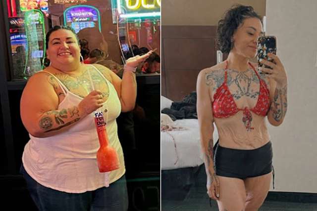 Jennifer before and after having Gastric Sleeve surgery at UCLA.