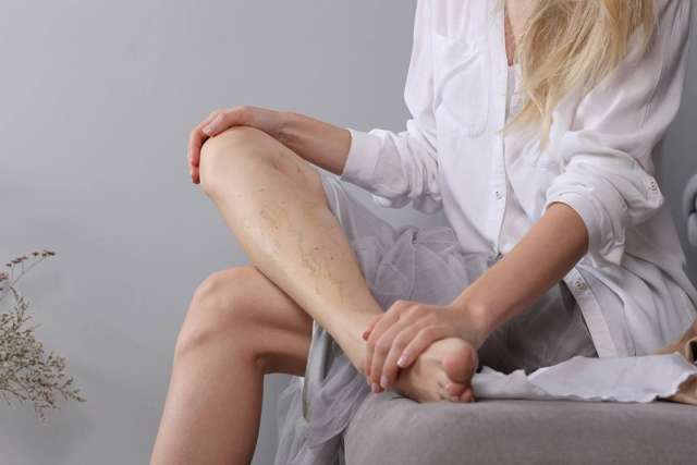 Person sitting on a couch wearing a white shirt and gray skirt, holding one leg with visible varicose veins.