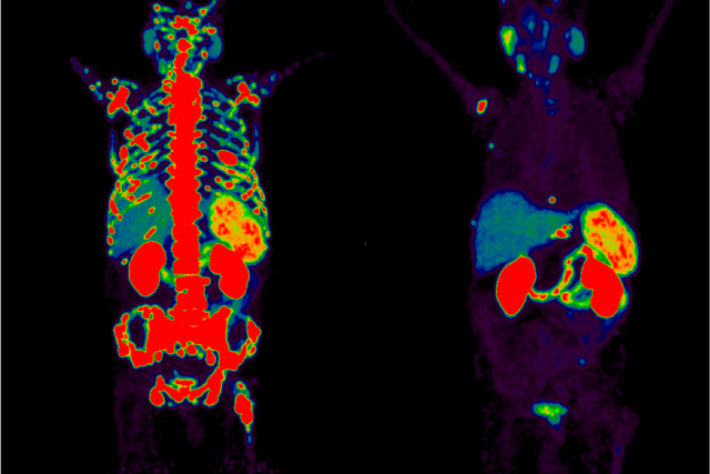 Dual thermal imaging of a human body, highlighting skeletal and organ structures.