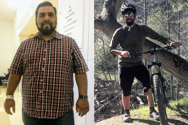 Daniel's Story - Before and After Gastric Sleeve Surgery