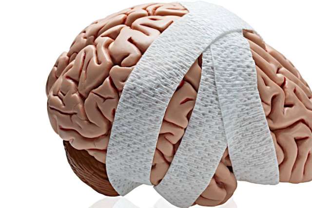 Model of a human brain wrapped with white bandages, symbolizing injury or recovery.