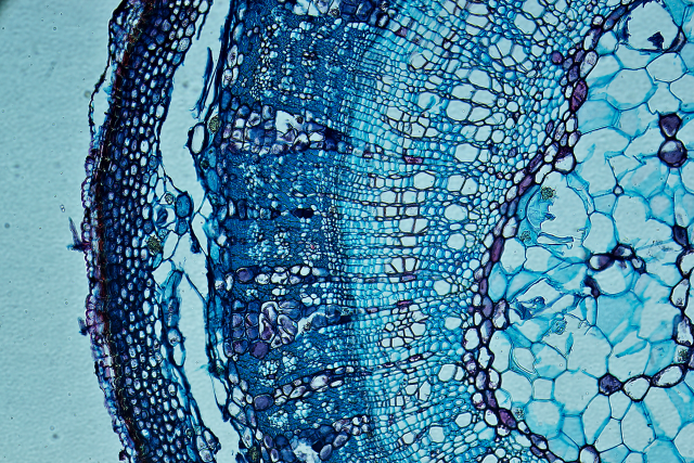 A microscopic view of breast tissue