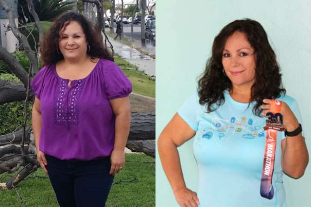 Monica's Story - Before and After Gastric Sleeve Surgery