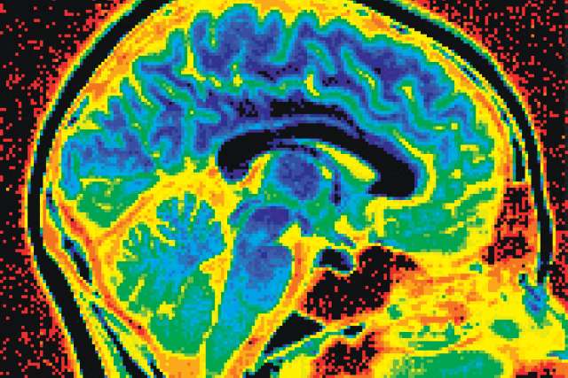 Colored scan of the brain
